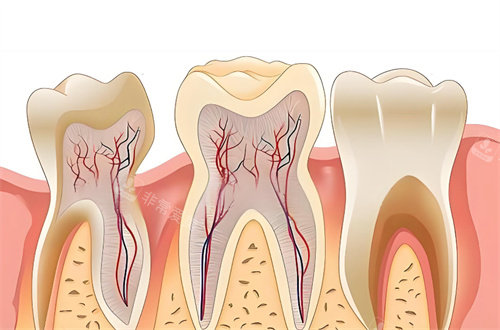 根管治疗卡通图片