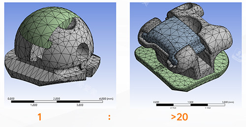 牙齿矫正OBrace球面托槽对比方形托槽