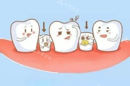 小孩子乳牙滞留卡通图