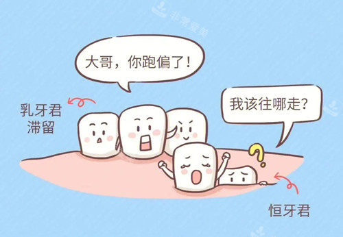 乳牙滞留漫画.webp