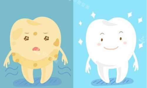 牙齿美白前后对比图