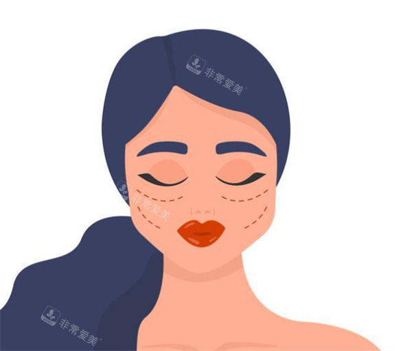 韩国4ever皮肤科技术...