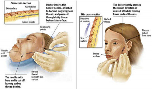 韩国rera皮肤科正规吗...