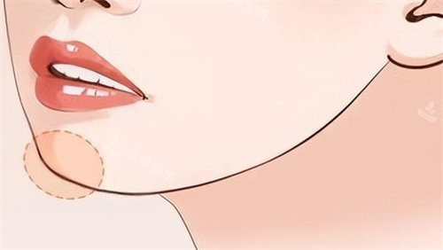 下巴填充对比 卡通 下巴填充对比 卡通