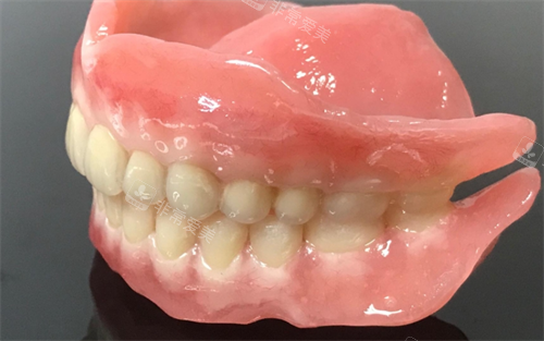 吸附式假牙全口模型展示