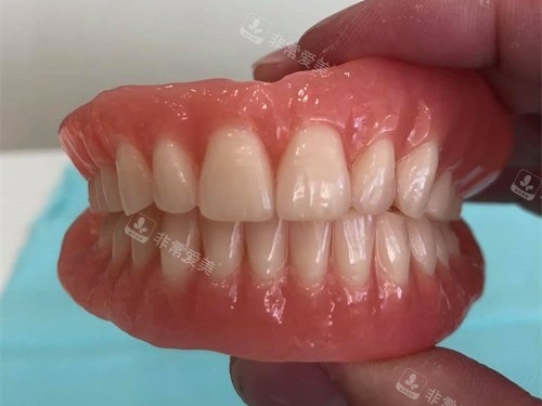 全口吸附性义齿实物图