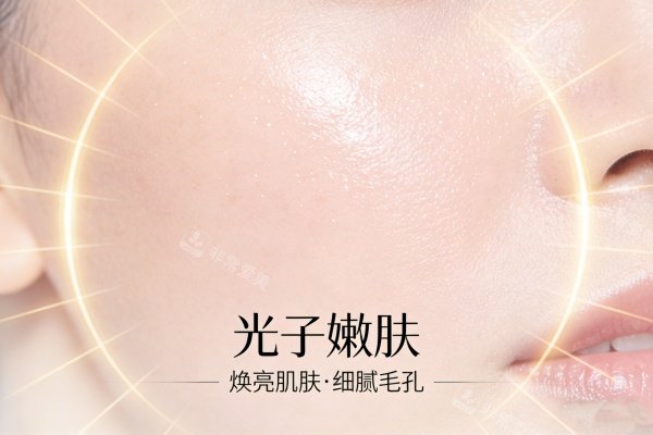 光子嫩肤作用卡通图展示