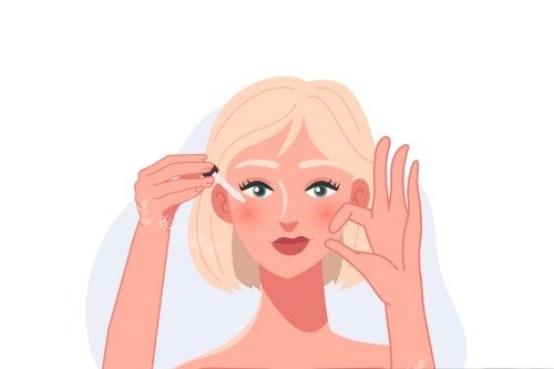 面部双眼皮手术_