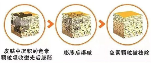 超皮秒原理 超皮秒原理