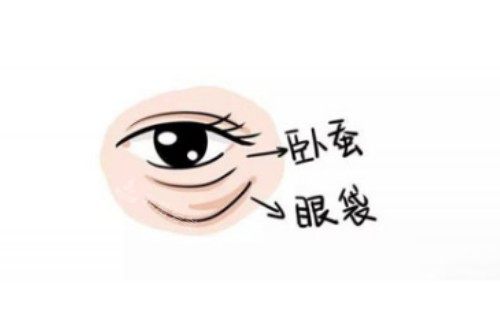 卧蚕、眼袋区别图