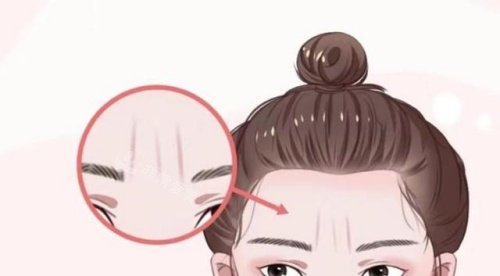 川字纹形态示意图