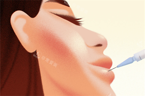 注射丰唇卡通图