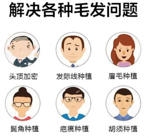 潍坊建中植发可解决问题