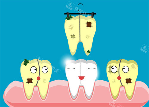 牙齿清洁卡通图片