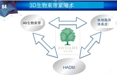 3d生物束带紧缩术讲解示意图