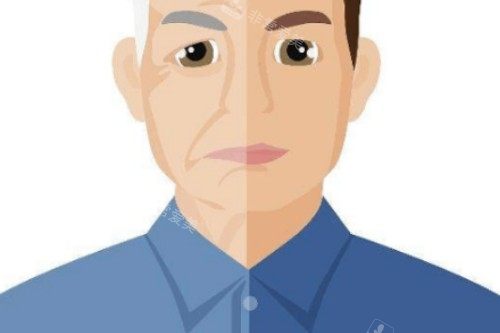 面部衰老提升卡通对比图