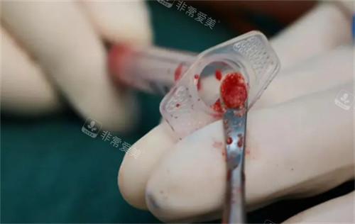 取出不明注射物