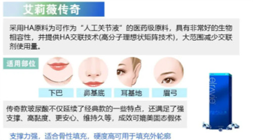 艾莉薇传奇玻尿酸适用部位