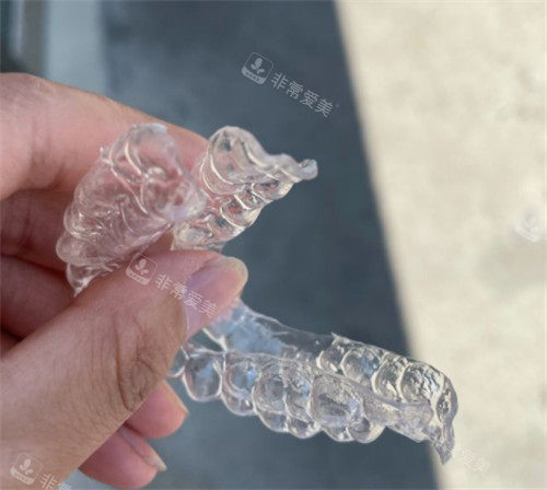 国产隐形牙套照片