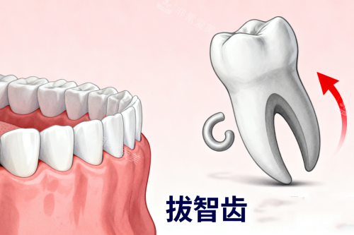 拔智齿卡通一览图