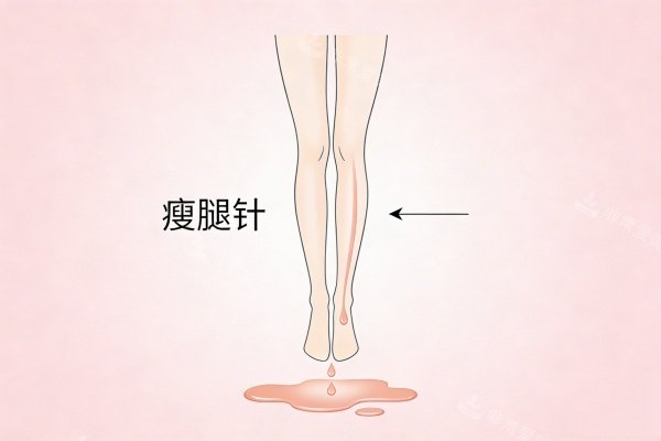 注射针剂瘦腿卡通图展示