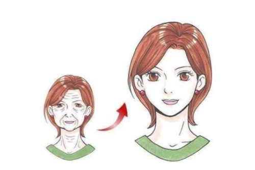 面部拉皮提升卡通對比圖 面部拉皮提升卡通對比圖