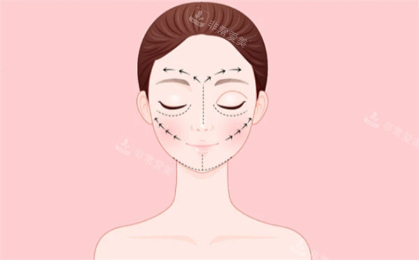 輪廓整形卡通圖片