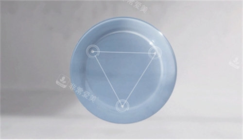 目立康角膜塑形镜的设计