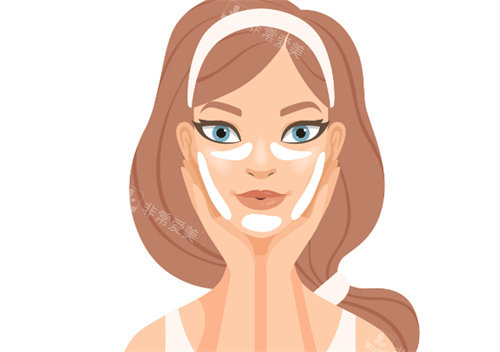 面部提升注射区域