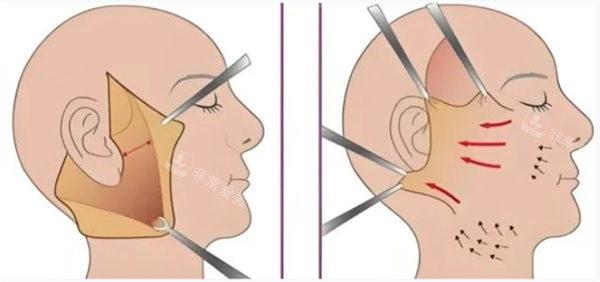 江南daybeau皮肤科口...