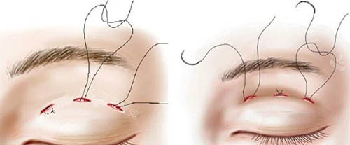 吉林市中妍整形美容好不好？本地老牌医美机构，技术扎实，眼鼻整形口碑超赞