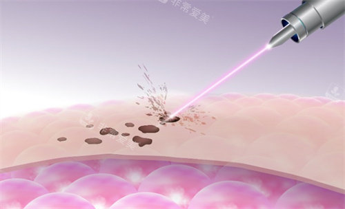 韩国Dr.Evers皮肤科怎么样？30家连锁+中文服务，游客零障碍体验的“轻医美”！