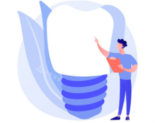 种植牙科普知识图