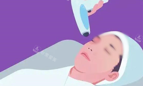 热玛吉操作示意图