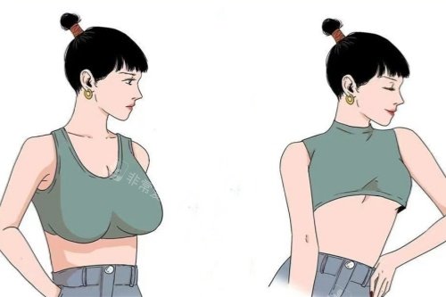 大胸縮小卡通對(duì)比圖 大胸縮小卡通對(duì)比圖