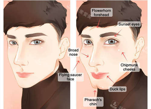 男性面部填充图