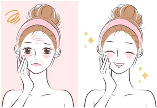 韩国布里亚皮肤科怎么样？主打水光抗衰、弱酸嫩肤、注射微调，本地人多、审美自然真实口碑解析！