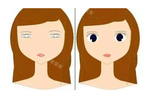 眼皮松弛做双眼皮对比图
