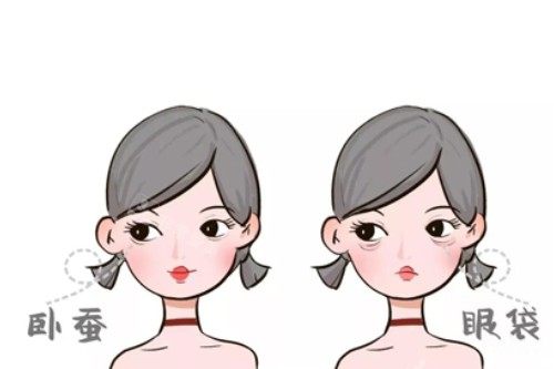 卧蚕、眼袋卡通对比图