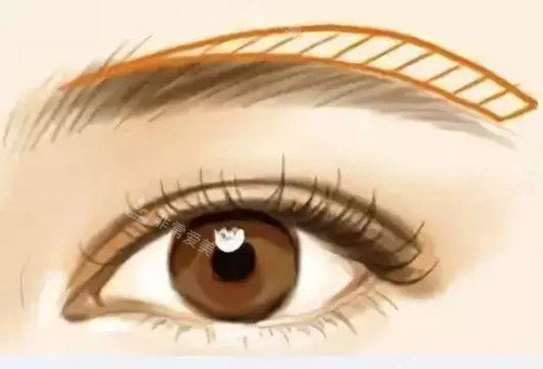 韩国做提眉哪家整形医院好一些？这三家是本地人也常去的口碑机构！