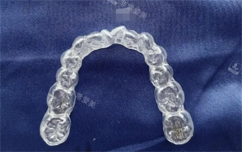 时代天使隐形矫正器