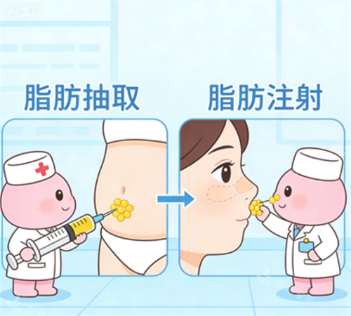 脂肪移植过程