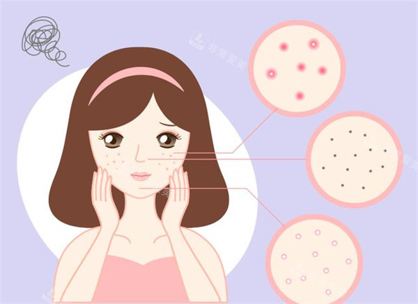 祛痘通用卡通图