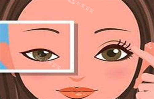 雙眼皮對(duì)比 雙眼皮對(duì)比