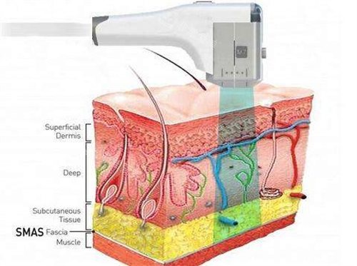 超聲儀器示意圖 超聲儀器示意圖