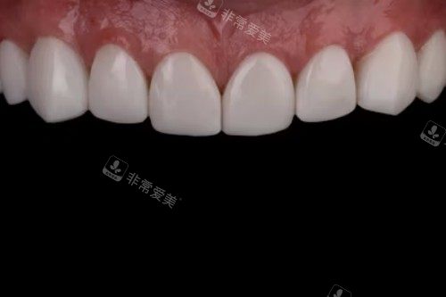 牙齿护理宣传图