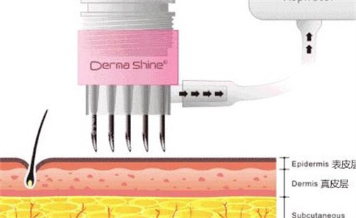 初次去韩国整形要准备什么？亲身实测全攻略，证件、资金及术前准备不踩坑