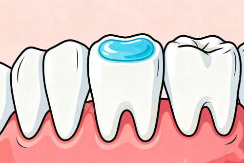 牙齿清洁卡通展示图