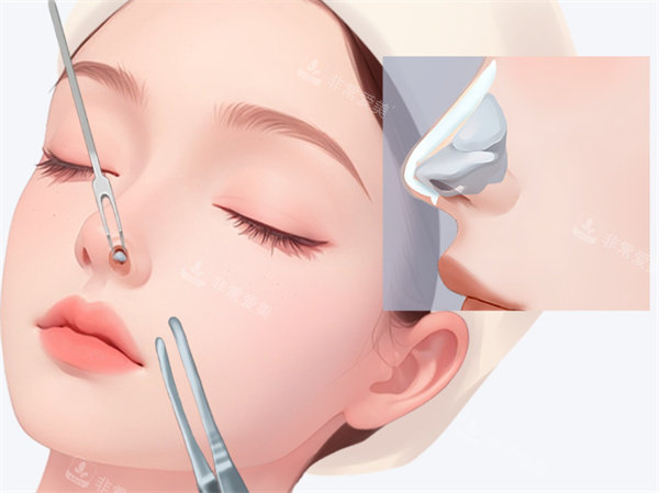 西安高一生美容医院好不好？老牌正规医美，技术扎实，眼鼻抗衰结果都很赞