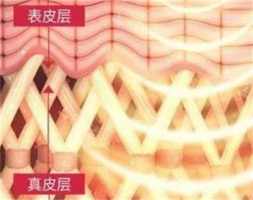 fotona4d欧洲之星作用层次